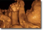 3D ultrasound